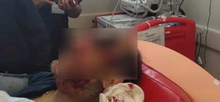 Termina con desarmador en el ojo por pelea en plaza comercial