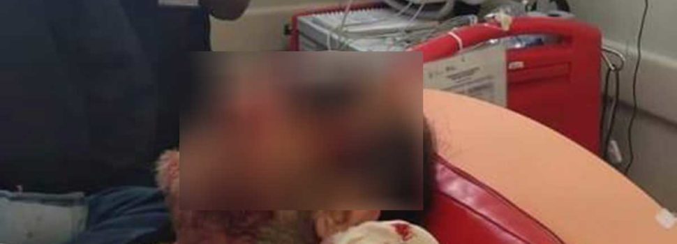 Termina con desarmador en el ojo por pelea en plaza comercial